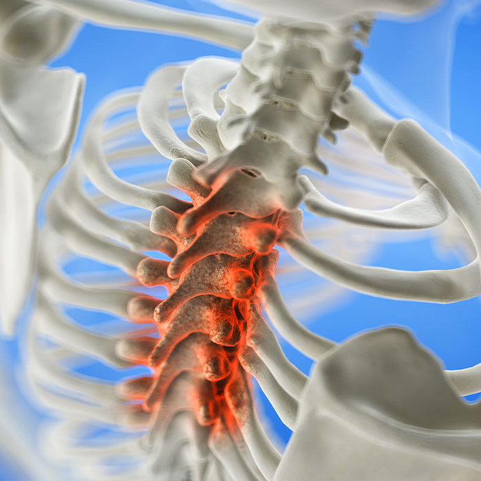spinal Stenosis treatment in Camp Springs